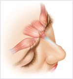 botox injection Botox Tampa