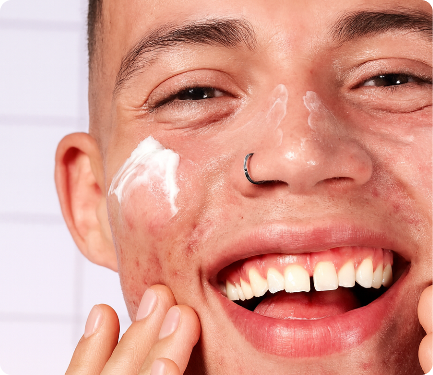 Man applying NuSkin Acne Max cream