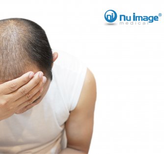 Thoughts On the Confusing Stigma of Men’s Hair Loss