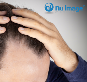 Four Things That Can Stop Hair Loss